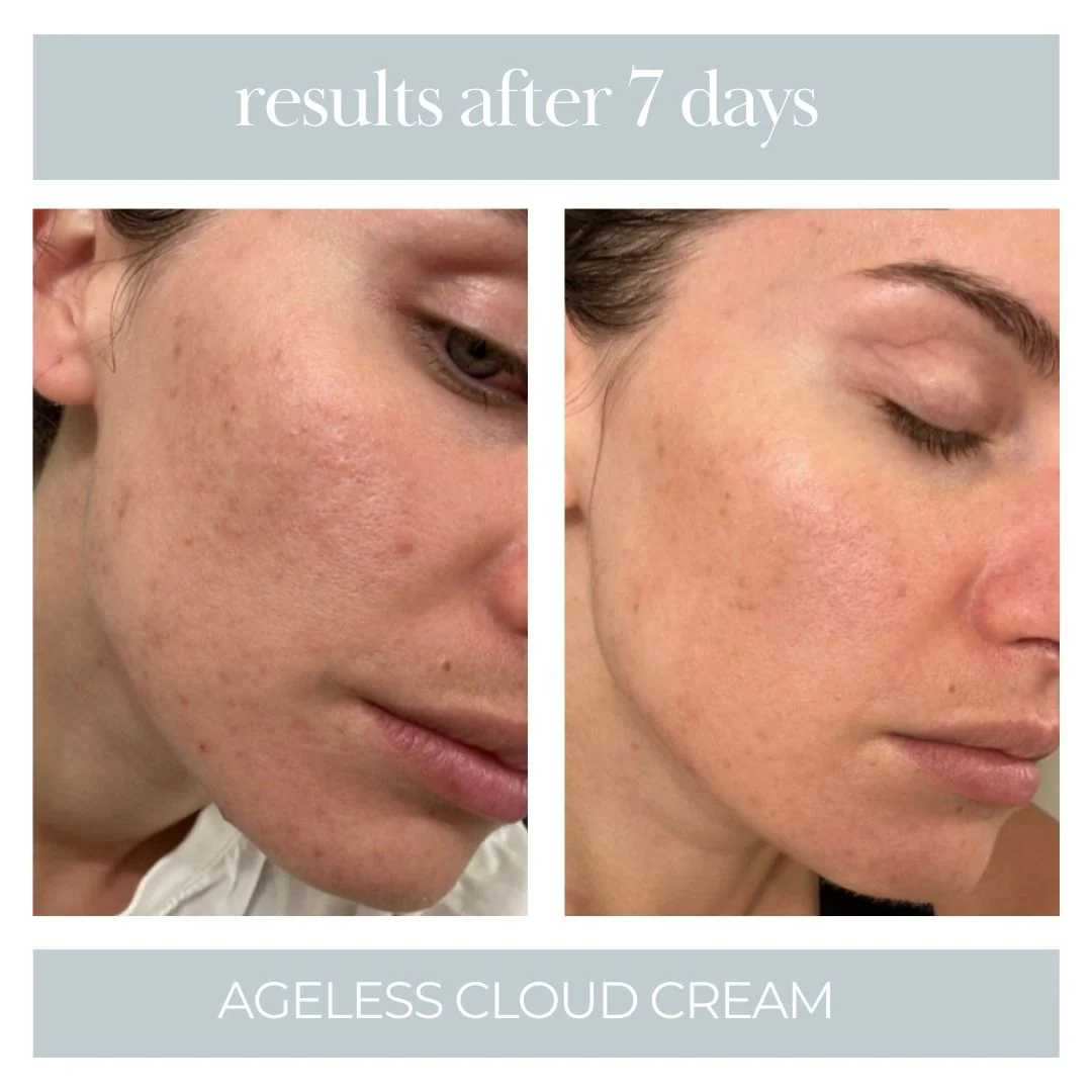 Ageless Cloud Cream - Image 5