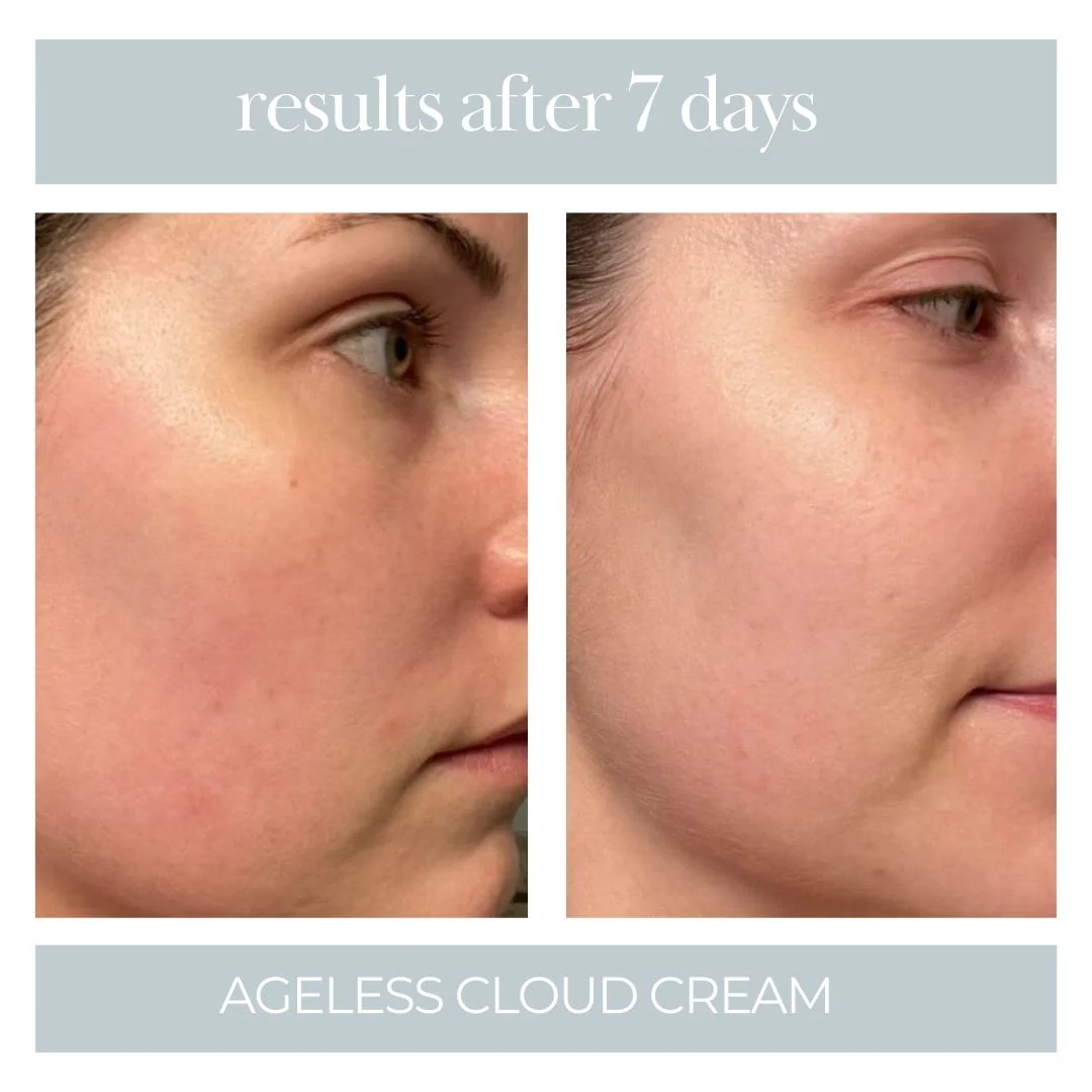 Ageless Cloud Cream - Image 7