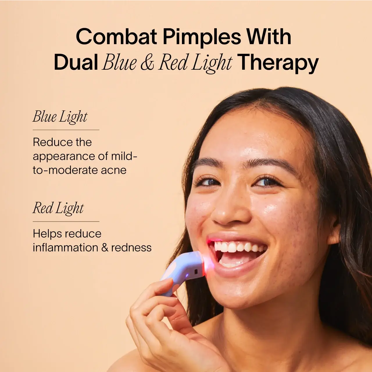 Bye Acne: 3-Minute Pimple Spot Treatment - Image 2