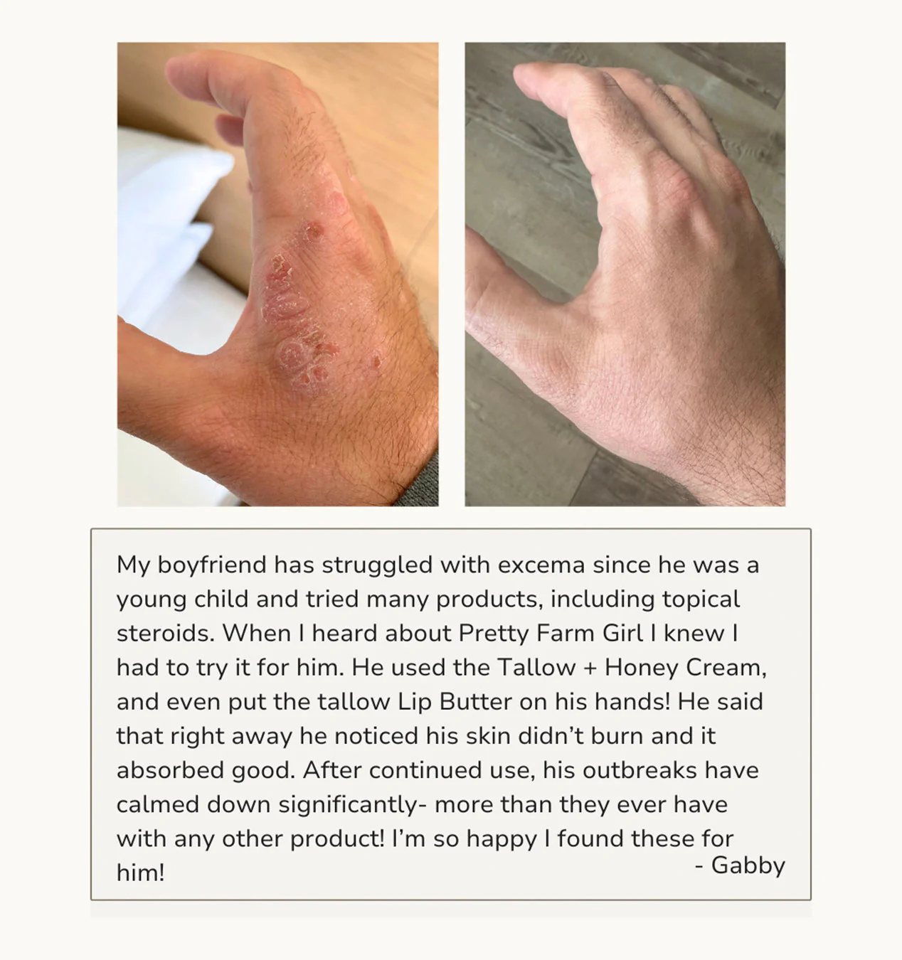 Fragrance Free Tallow + Honey Cream for Sensitive Skin - Image 5