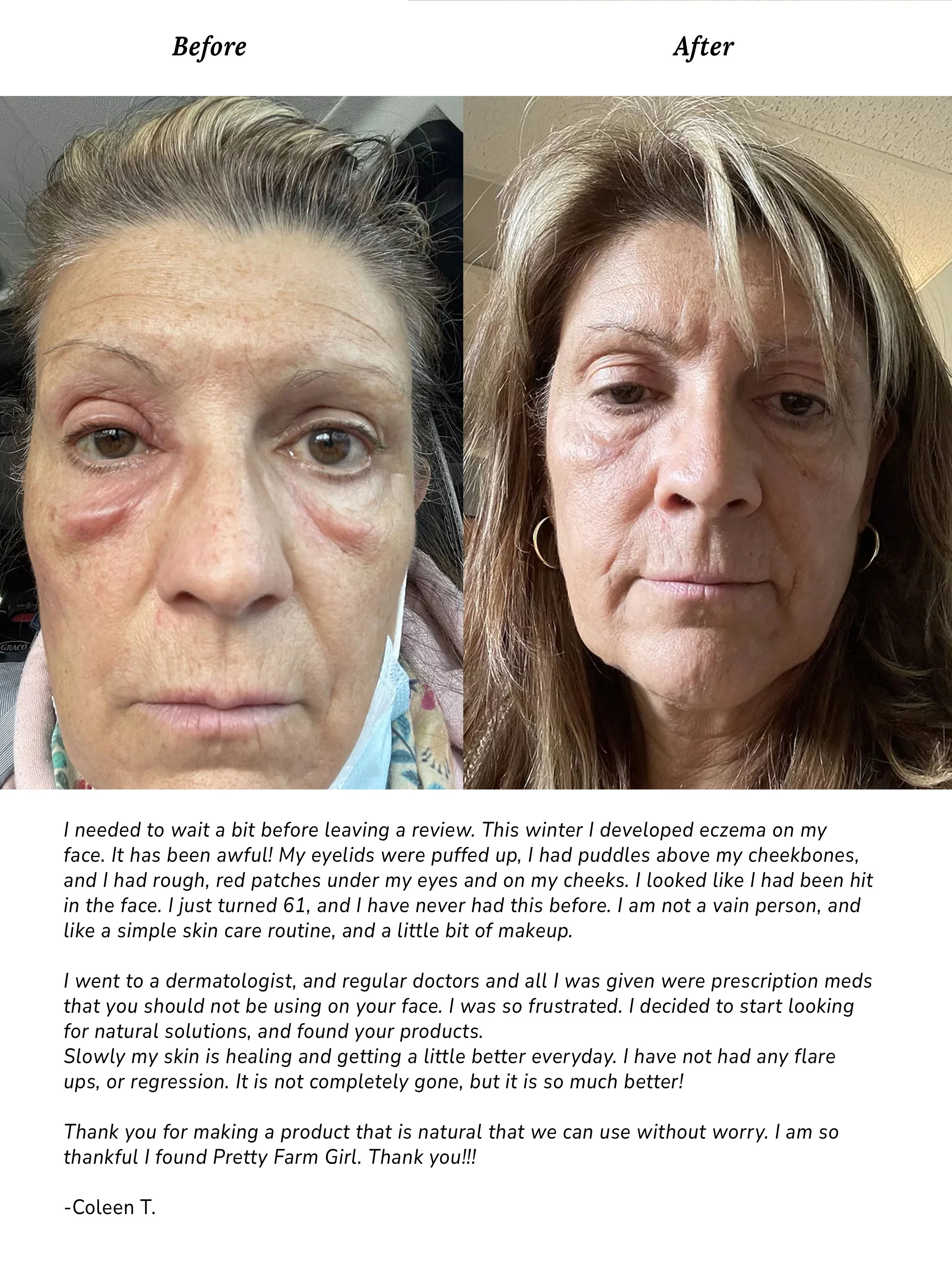 Pure + Simple Skin Kit for Sensitive Skin - Image 4