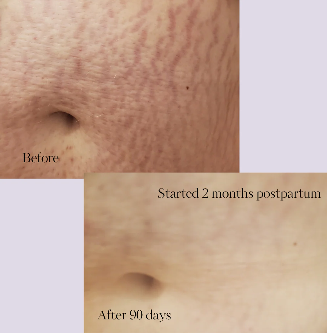 Revitalize Postpartum Cream 4oz - Image 4
