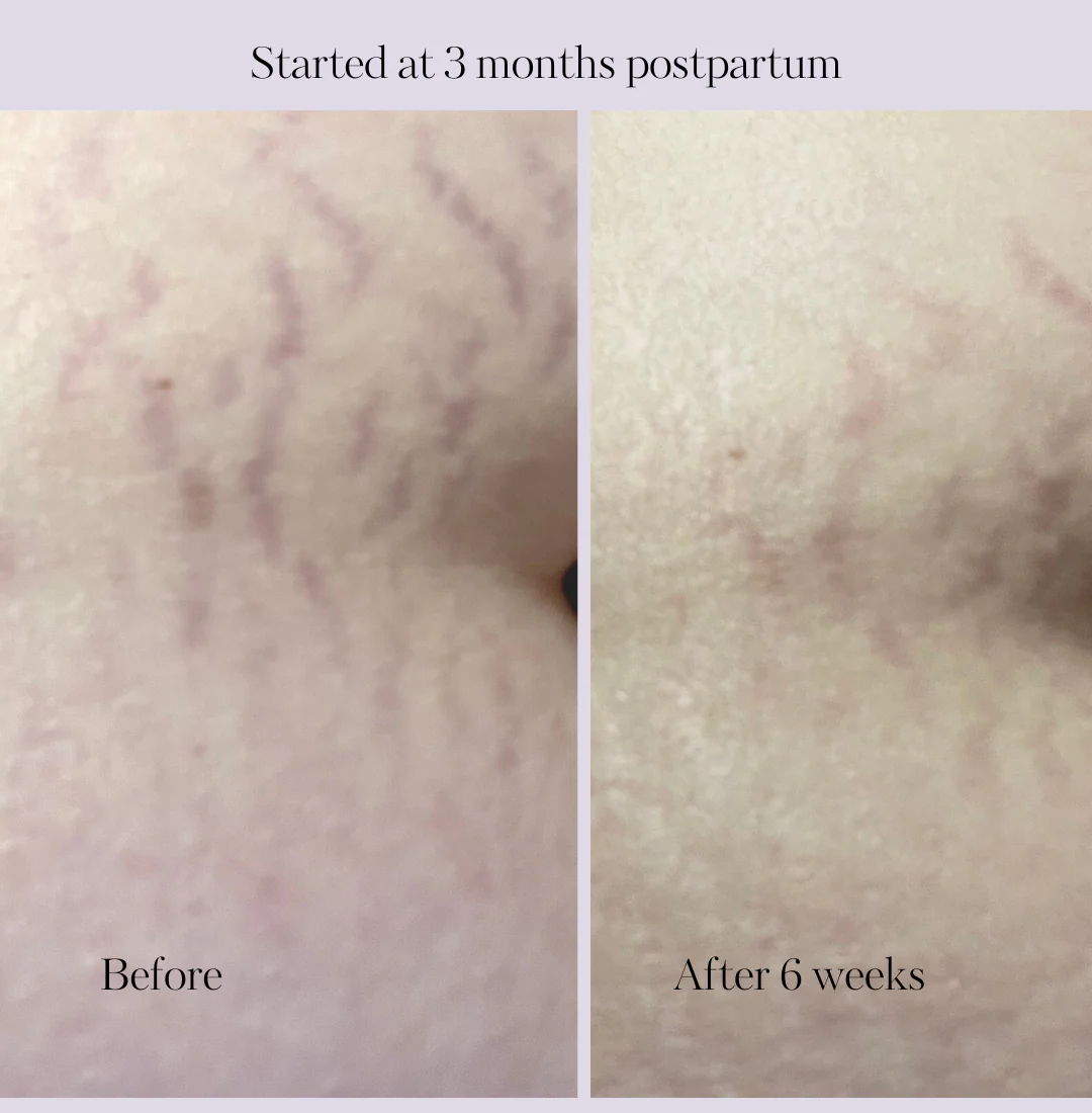Revitalize Postpartum Cream 4oz - Image 6