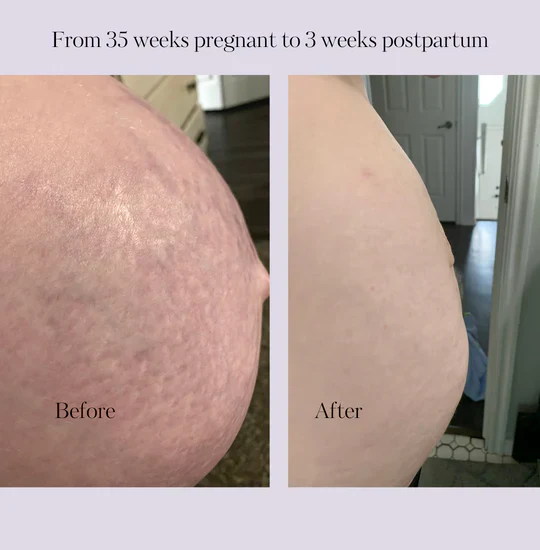 Revitalize Postpartum Cream Refill Pouch - Image 3