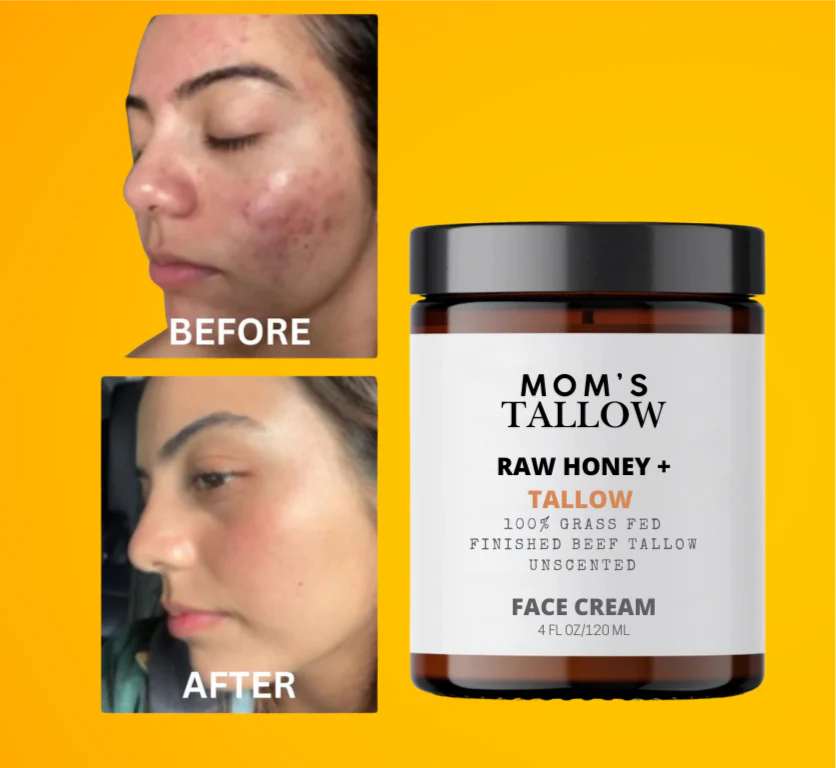 Skin Serenity Face Cream – Nourishing Balm for Sensitive & Flaky Skin - Image 2